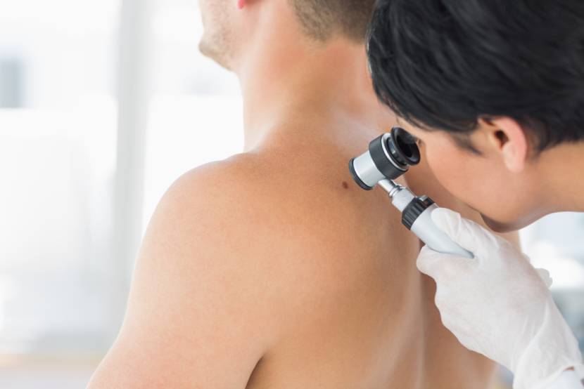 Dermatología Oncológica en Tlalpan CDMX